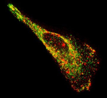 科学家研发新技术 可毁灭细胞中与疾病有关RNA
