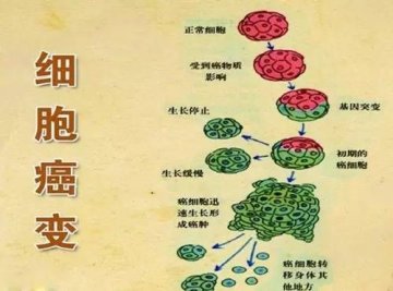 中医如何对付肿瘤