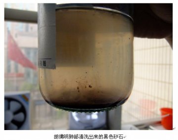 人文故事：黑色尘肺“洗”出健康