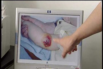 2012健康年鉴：年度十大最受关注疾病
