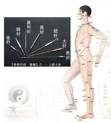 九种中医药绝活羊城献宝