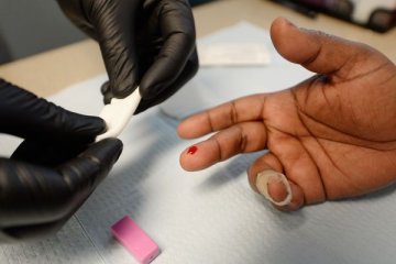 美国疾控中心：黑人HIV病毒携带者的死亡率仍然最高