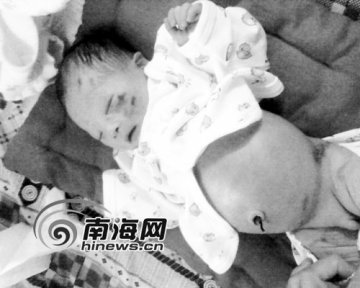 患病新生儿被弃垃圾房 脸部带伤疑遭老鼠啃咬