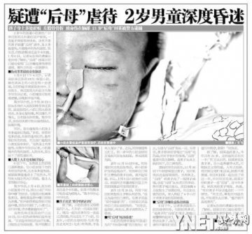 男童疑被后母虐待病情告急 亲生父母两天未现身