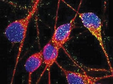 英科学家首次成功利用人类皮肤生成大脑细胞