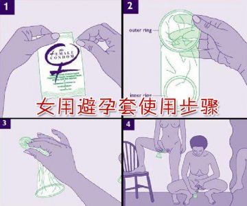 女用避孕套使用步骤