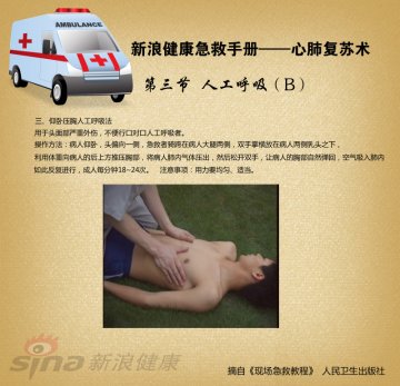 心肺复苏术07-人工呼吸(B)仰卧压胸人工呼吸法