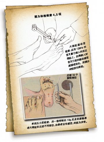 糖尿病周围神经病变的查和治