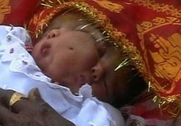 印度夫妇生下双面女婴 两只嘴巴四只眼