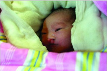 医院楼道现兔唇弃婴 目击者称为2男1女丢弃