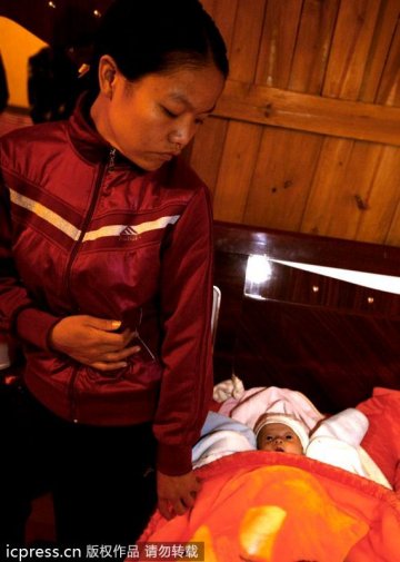 5个月男婴得怪病肚如气球