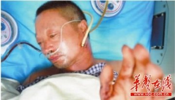 男子被拇指粗钢筋穿头过 医院紧急抢救脱险