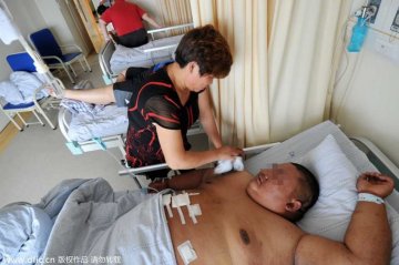 南京406斤“大胃王”手术减重