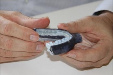 澳洲科学家使用3D打印牙垫治疗睡眠呼吸暂停