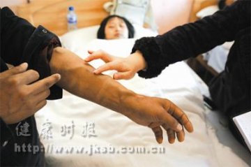 尿毒症患者的自救生活