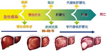 对抗肝炎，见“毒”行事