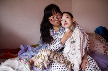 实拍尼曼皮克氏病患者的生活
