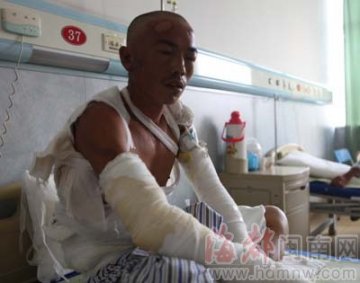 男子硬闯火场冒死救母 因全身多处烧伤送院