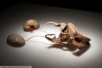 女性生殖系统