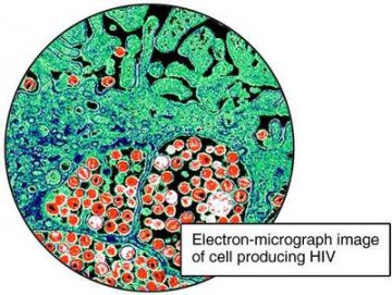 模拟电镜下观察的HIV