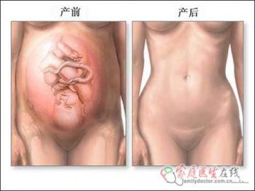 医学图解：剖腹产手术全过程