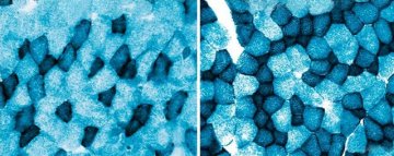 科学家发现与肌肉耐力有关基因