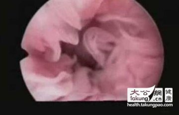 神奇的生命：实拍女性排卵真实过程