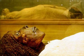 科学家称癌症是“人造”现代病 古代无癌症
