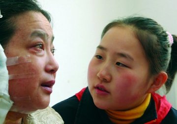 12岁女孩照顾重病母亲 母女1顿饭花5元