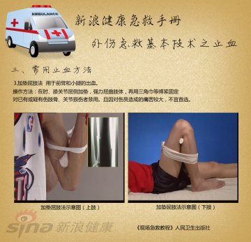 常用止血方法：加垫屈肢法