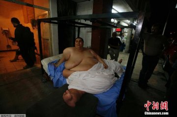 世界最胖男人因病去世 曾连续9年卧床不起