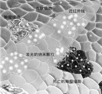 纳米医学，一个充满了创新机遇的新领域