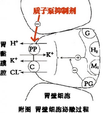 应激致溃疡 善用质子泵抑制剂