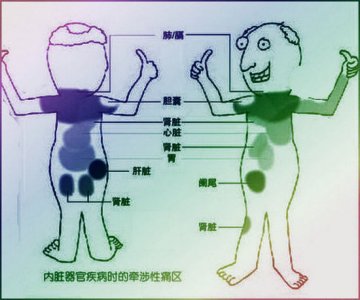内脏疾病对应疼痛图靠谱么