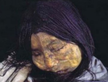 健康探秘：揭开“冰处女”的神秘面纱