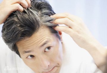 白发早生具有遗传性