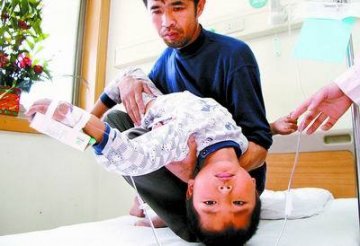 全球最恐怖的67种怪病