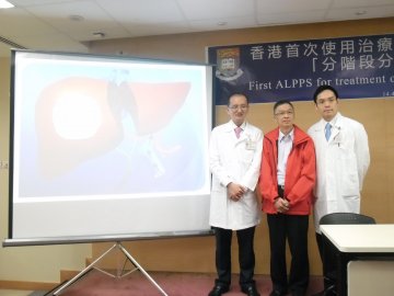 玛丽肝癌新手术零失误