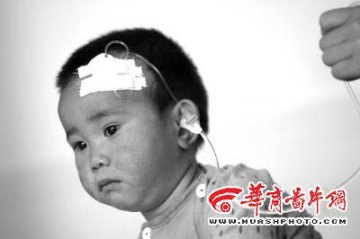 女童输入问题注射液后抽风