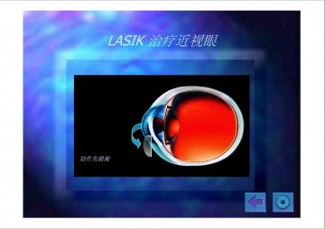 lasik2