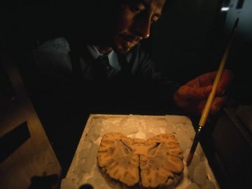 人类大脑切片