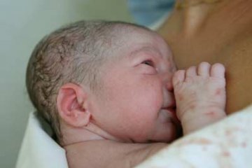 夏季新生儿四类皮肤问题