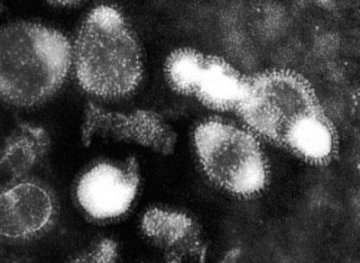 科学家发现流感病毒控制人类细胞方式