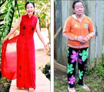 乱吃药引皮肤病26岁美女变70岁老太