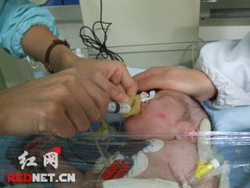 湖南小人鱼开始自主吸奶 医师称状况转好