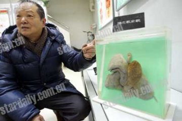 人体知识展览错误百出 肺器官被划到消化系