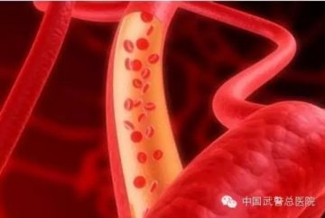 你掉进误区了吗？军医解答关于输血的那点事宜
