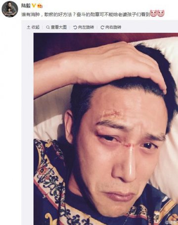 陆毅面部受伤寻良方 给他支几招