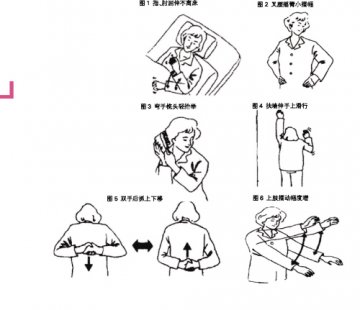 乳癌术后康复保健操，动作须渐进