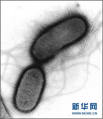 中德研究确认欧洲肠病病原复杂 德已有约2千病例